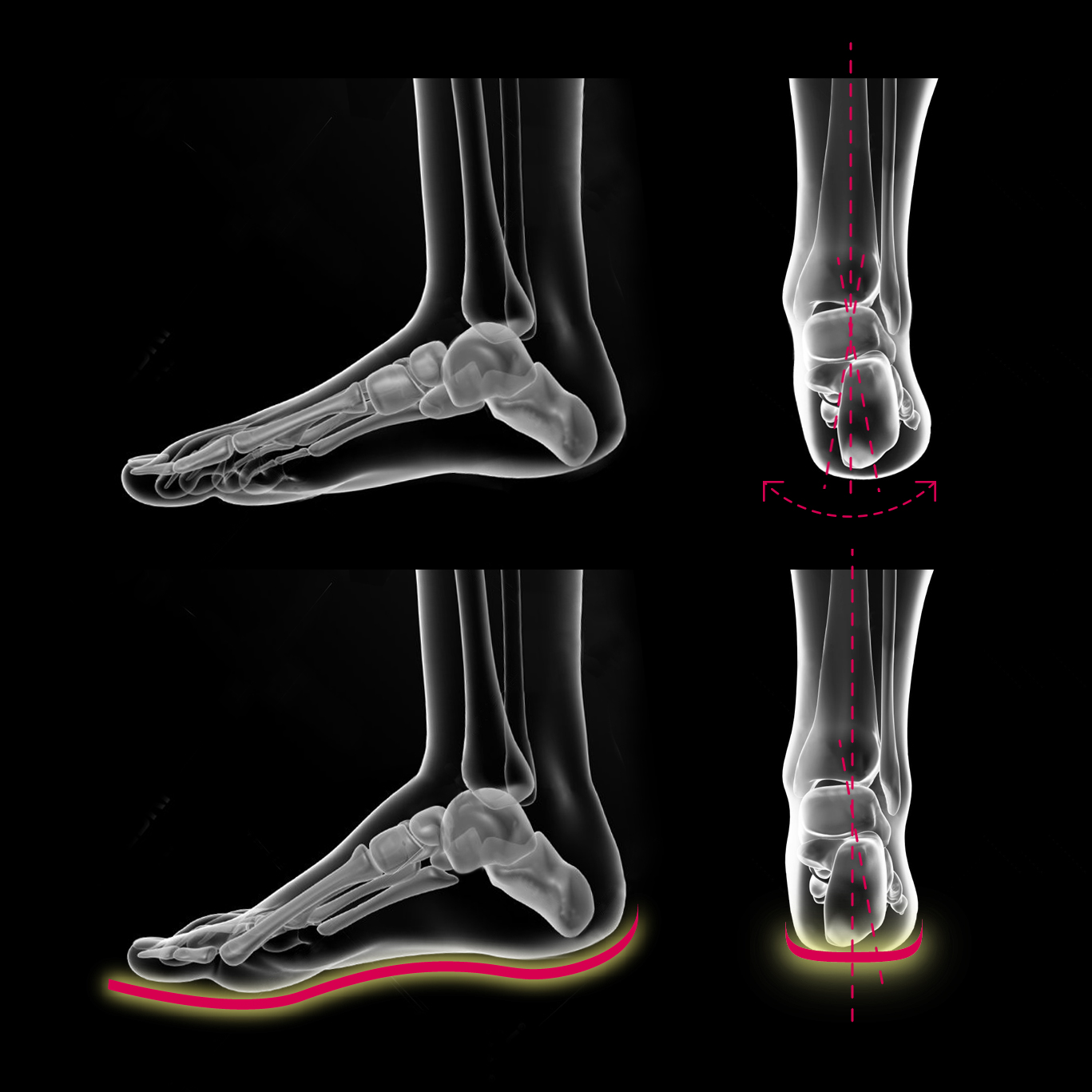 ブリリオによるサポート